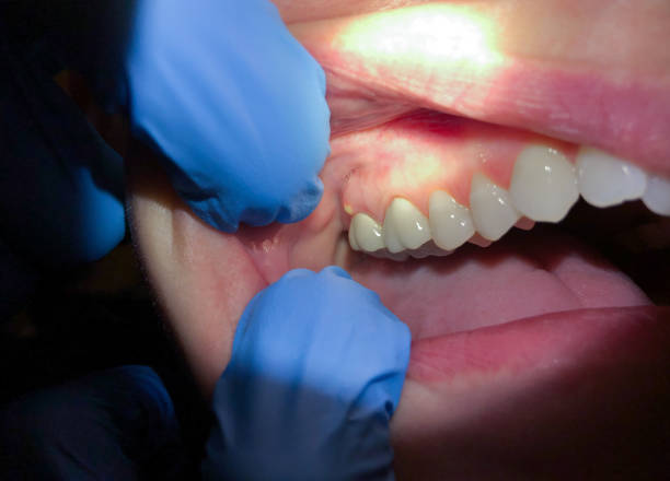 Best Tooth Pain Emergency Relief  in Mdleton, ID