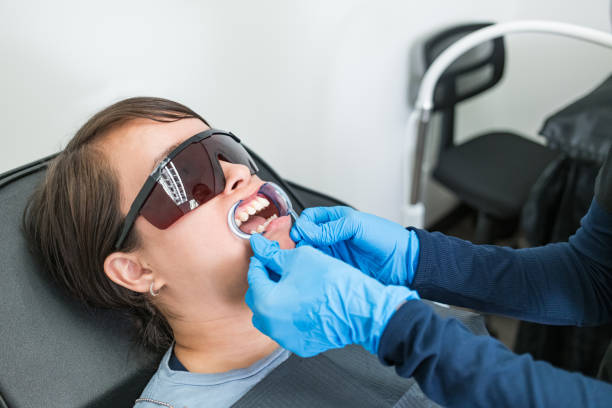 Best Teeth Whitening  in Mdleton, ID